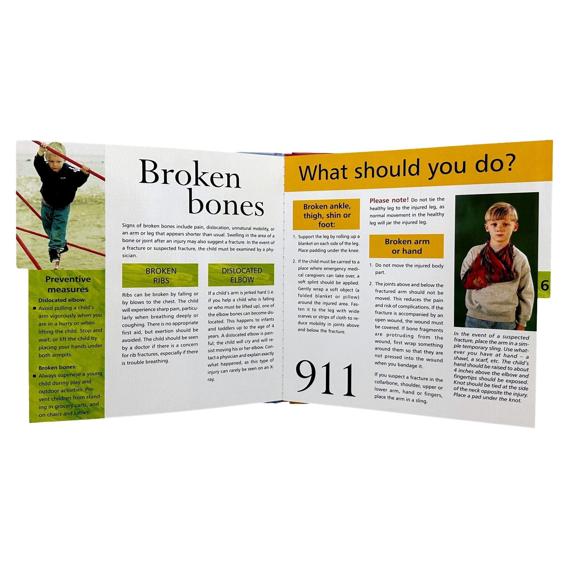 A guide about broken bones and a child modeling a temporary sling.